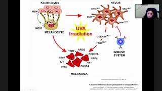Классификация и патогенез меланомы кожи