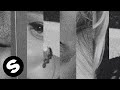 NERVO, Plastik Funk & Elle Vee - Crazy (ASHER SWISSA Remix) [Official Audio]