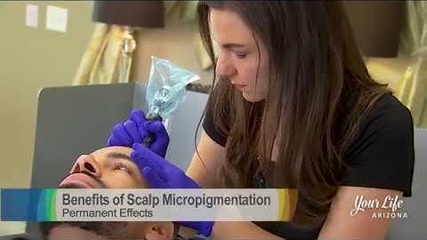 Scalp Micropigmentation Scottsdale, AZ
