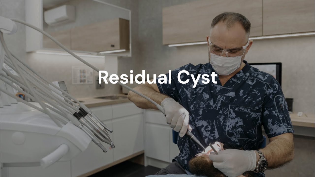 Residual cyst | Radiographic features