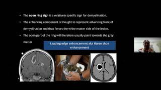 NEUROIMAGING SPOTTERS 1 Dr SHARATH screenshot 3