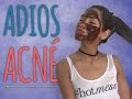 Mascarilla para el acné | mascarilla hidratante