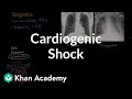 Understanding the Heart and Cardiogenic Shock