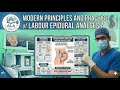 Modern Principles and Practice of Labour Epidural Analgesia#medicine#science#anaesthesia #obstetrics