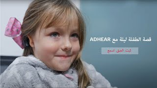 قصة ليلة مع نظام التوصيل العظمي ADHEAR