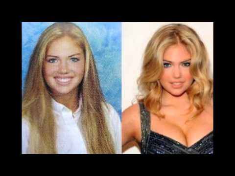 Kate Upton Breast Implants