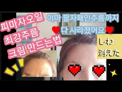 피마자오일굵은주름잔주름없어집니다,이마주름없애는법,신비의오일팩실험해봤어요,피마자오일효능,히알루론산,보르피린,