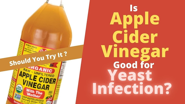 Douching with apple cider vinegar for yeast infection