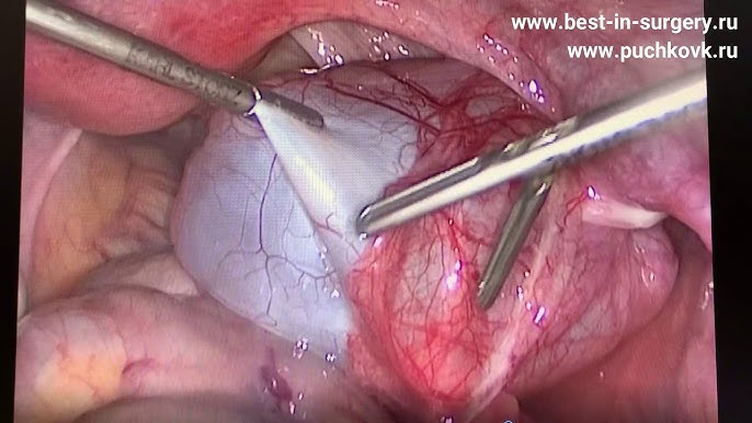Белдікпен бөкседегі порно Тордағы жалаңаш