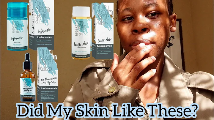 Skin Fundamentals Review: My Honest Thoughts on Niacinamide, Lactic Acid & Toner