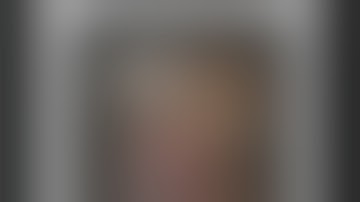 AIOC2018 - IC167 - Topic - Steps in squint surgery (VAST) - Prof.Rohit Saxena