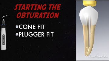 warm vertical compaction endodontic continuous wave obturation Fast-Fill Fast-Pack from Eighteeth