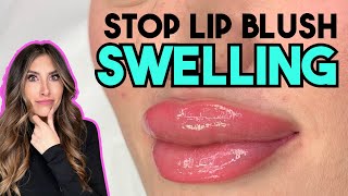 AVOID LIP BLUSH TRAMA AND SWELLING Wealth