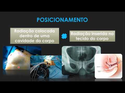 Vídeo: Paisagem Genômica Do Câncer Colorretal No Japão: Implicações Clínicas Do Seqüenciamento Genômico Abrangente Para Medicina De Precisão