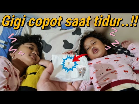 Hanum Bingung Gigi Bocil Copot saat Tidur! | Shafeea Hanum