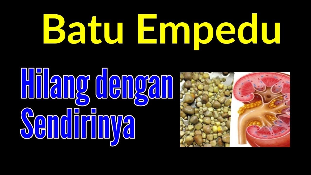 Akhirnya Ini yang Di Tunggu I Cara Mengobati Batu Empedu Secara Alami