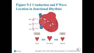 Chapter 9: Rhythms Originating in the AV Junction lecture, part I