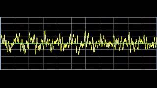 Chronic Fatigue Syndrome - Rife Frequencies