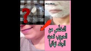 القضاء على الحبوب تحت الجلد، و النّتيجة من الإستعمال الأوّل.