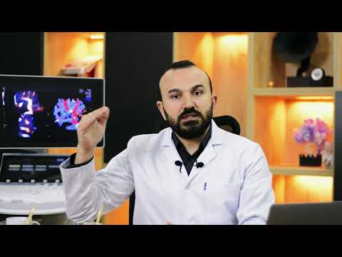 Toksoplazma Nedir? I Doç.Dr. Ali Ekiz