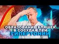 Образование бляшек в сосудах при гипертонии!