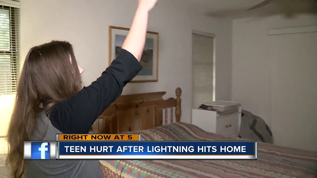 Lightning Strike Rash Teen develops mysterious rash after lightning strikes her Palm Harbor ...