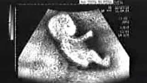 bambino nella pancia della madre che fa una cosa ...BIZZARRA