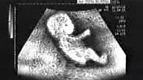 Perché i bambini piangono nella pancia?