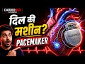 दिल की मशीन? ⚡ PACEMAKER कैसे बचाता है जान! | समझें केवल 7 मिनट में | CardioNex Academy 