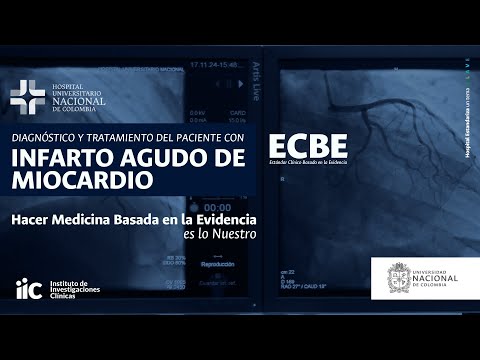 ECBE Infarto Agudo Miocardio - Resumen