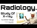 Radiology xrays study i by i dr jineshwar yaligouda md professor and head of department anatomy