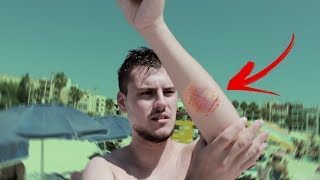 картинка: ме касна медуза