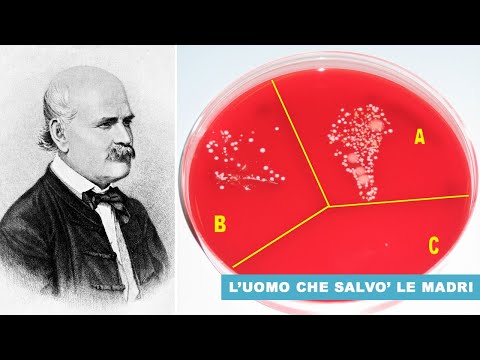 Video: Chi era ignaz semmelweis e cosa ha fatto?