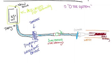 Setting up the Art Line, How the Transducer Works and Damping