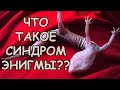 ЧТО ТАКОЕ СИНДРОМ ЭНИГМЫ И КАК ЕГО ЛЕЧИТЬ??