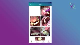 Smart Dent 02