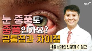 &quot;눈 중풍도 중풍인가요? - 공통점과 차이점&quot; / 서울브레인신경과 이일근
