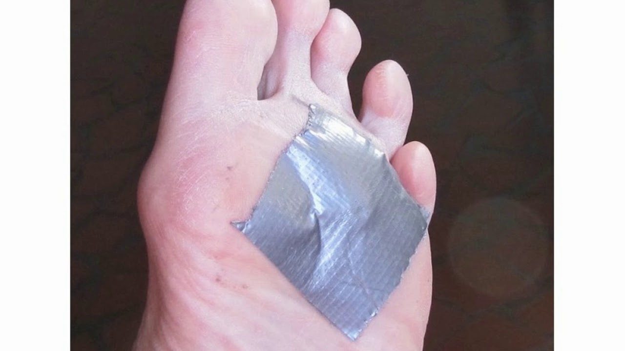 Difference Between Corn and Wart YouTube