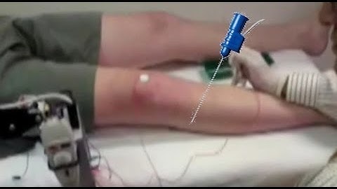 MS Month Day 3 - Courage