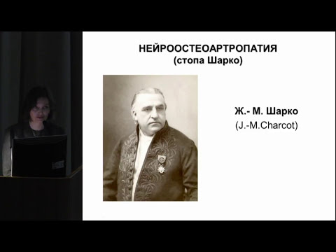 Комелягина Е.Ю. Диабетическая остеоартропатия (стопа Шарко): диагностика и лечение