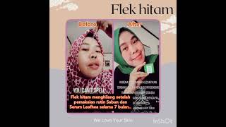 Setelah pakai sabun leafhea jadi kincelong