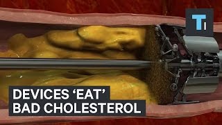 Devices 'eat' bad cholesterol screenshot 3