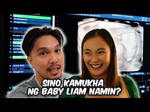 SINO KAMUKHA NG BABY LIAM NAMIN? | BenLy