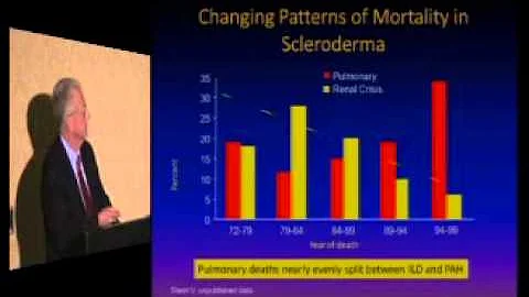 Interstitial Lung Disease in Systemic Sclerosis  -...