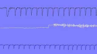 C64 SID REDEMPTION 6.4 Oscilloscope View