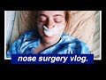 my septoplasty + recovery vlog