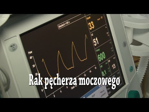 Rak pęcherza moczowego