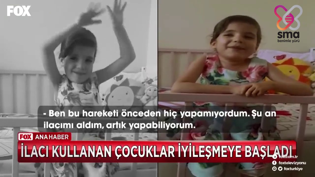 İlaç Kullanan SMA Hastalarında İyileşmeler Başladı, 29 Ağustos 2019 - (FOX Ana Haber)