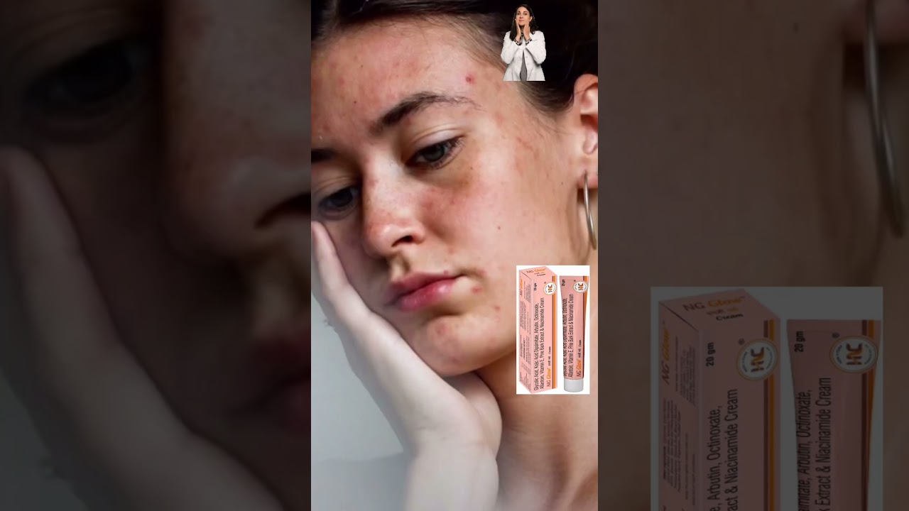 ng glow cream review in Tamil