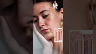 Ng Glow Cream Review In Tamil